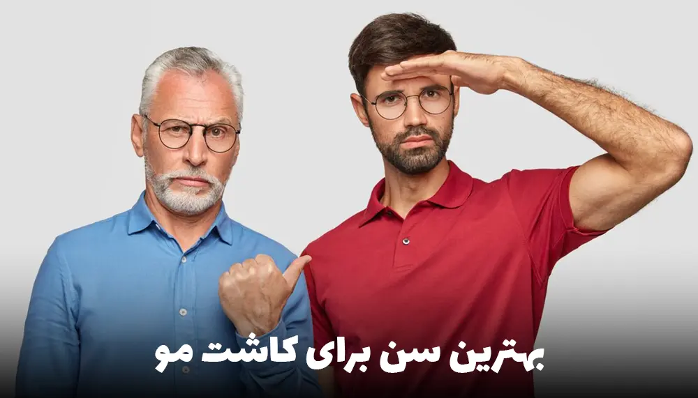 بهترین سن برای کاشت مو